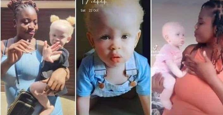 “9 Months in My Belly & You Chose To Look Different”: Mum of Albino Kid Shows Her Off, Her Beauty Causes Stir